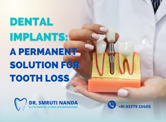 Dental Implants bhubaneswar