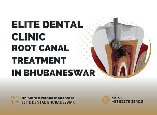 Elite Dental Clinic Root Canal Treatment in Bhubaneswar