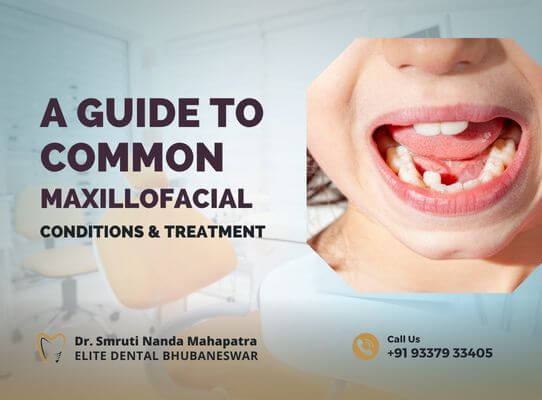 Maxillofacial Conditions and Treatment