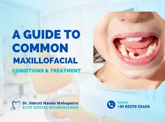 Maxillofacial Conditions and Treatment - elitedentalbhubaneswar.com