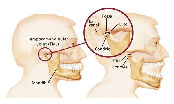 Temporomandibular Joint (TMJ) Disorders - Elite Dental Clinic