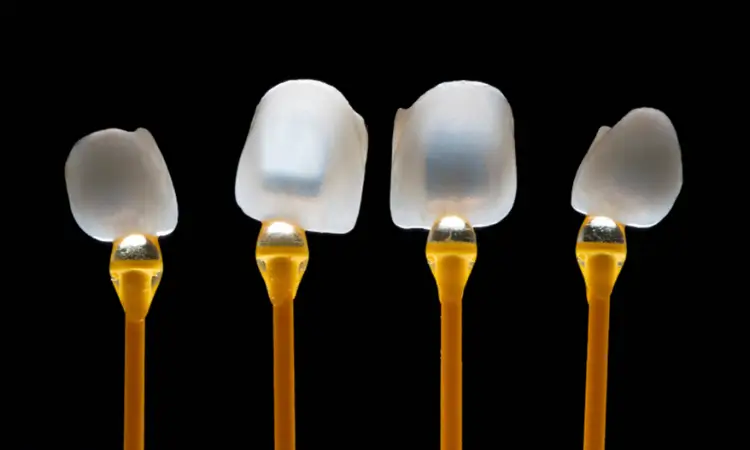 What are Veneers - elitedentalbhubaneswar.com