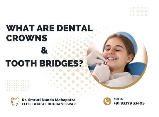 What Are Dental Crowns & Tooth Bridges