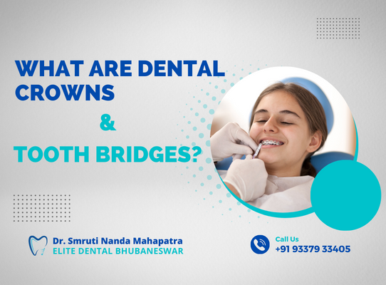 What Are Dental Crowns & Tooth Bridges