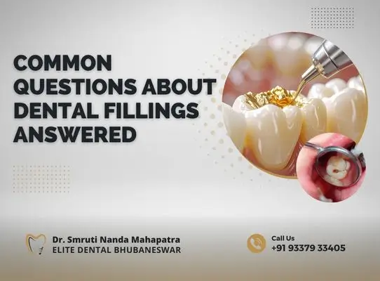 Common Questions About Dental Fillings Answered