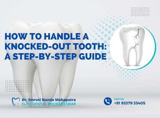 How to Handle a Knocked-Out Tooth A Step-by-Step Guide