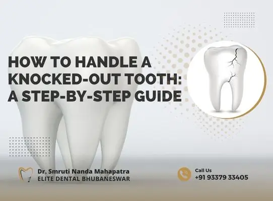 How to Handle a Knocked-Out Tooth A Step-by-Step Guide