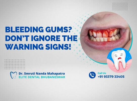 Bleeding-Gums-Dont-Ignore-the-Warning-Signs