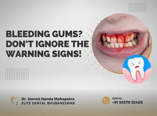 Bleeding Gums Don’t Ignore the Warning Signs!