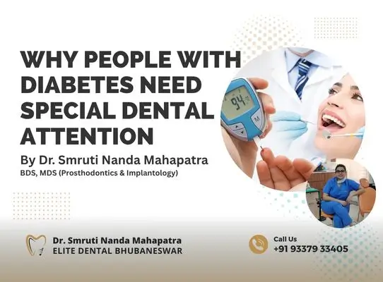 Why People with Diabetes Need Special Dental Attention