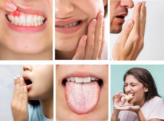 Common Monsoon Dental_Concerns & Their Remedies