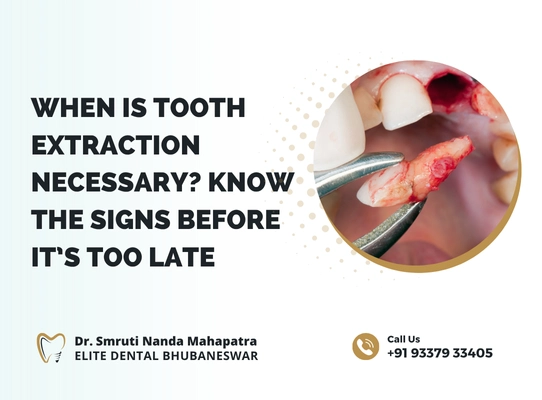 When Is Tooth Extraction Necessary Know the Signs Before It’s Too Late