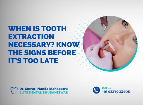 When Is Tooth Extraction Necessary Know the Signs Before It’s Too Late