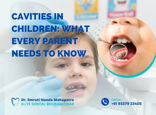 Cavities in Children What Every Parent Needs to Know