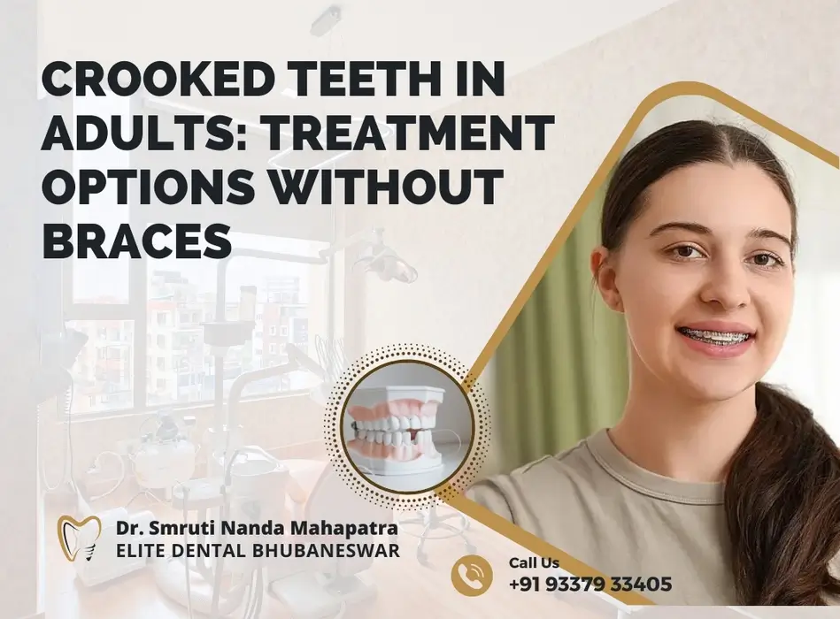 Crooked Teeth Solutions For Adults Easily