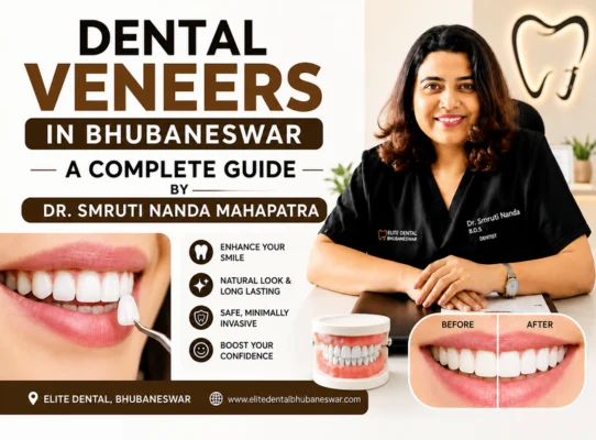 Expert Dental Veneers Smile Transformation Guide