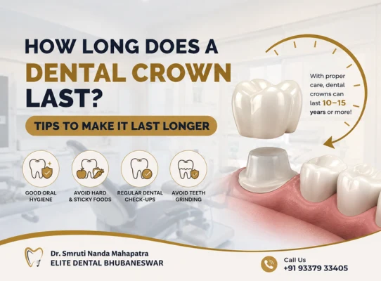 Expert Tips for Long-Lasting Dental Crowns