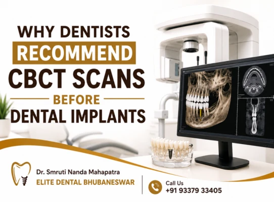 Advanced CBCT Scans for Successful Dental Implant Planning