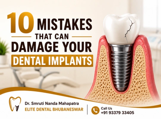 Dental implant care mistakes patients should avoid