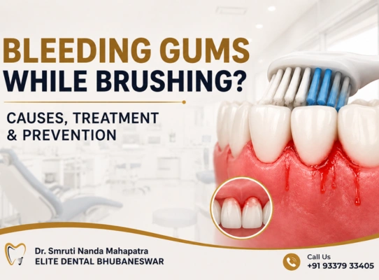 Understanding Bleeding Gums and Common Dental Causes