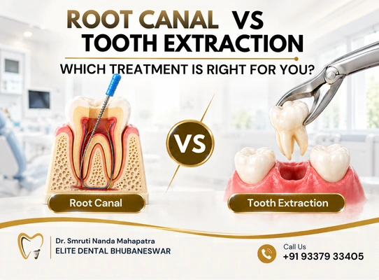Root Canal vs Tooth Extraction: Comparing Dental Treatment Options for Damaged Teeth
